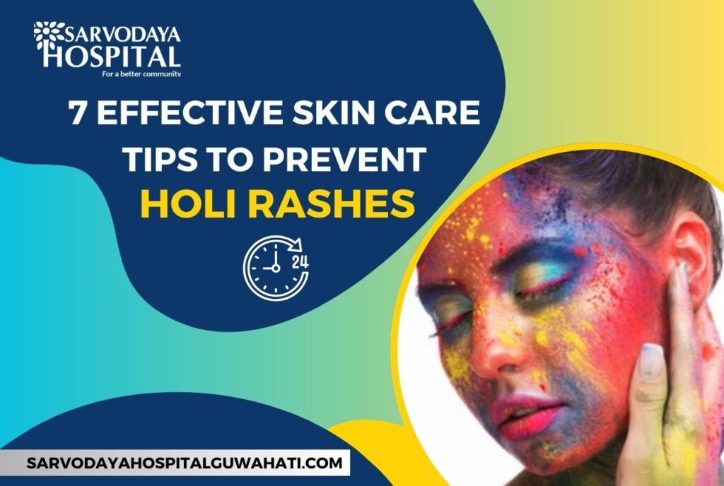 7 Effective Skin Care Tips to Prevent Holi Rashes