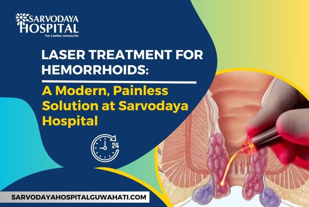 Laser Treatment for Hemorrhoids: A Modern, Painless Solution at Sarvodaya Hospital