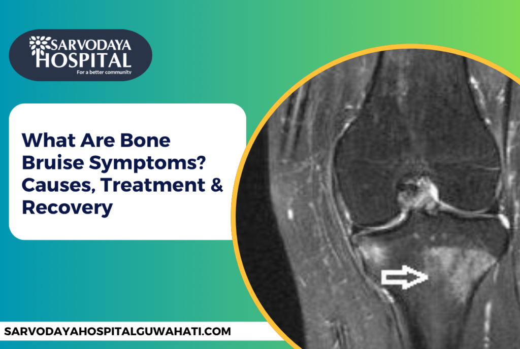 What Are Bone Bruise Symptoms? Causes, Treatment & Recovery