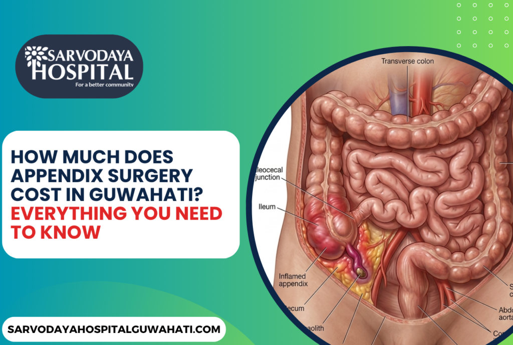 How Much Does Appendix Surgery Cost in Guwahati? Everything You Need to Know